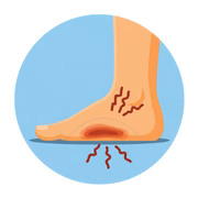 Achilles Tendinitis